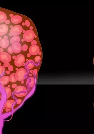 Pink Tentacle Creature