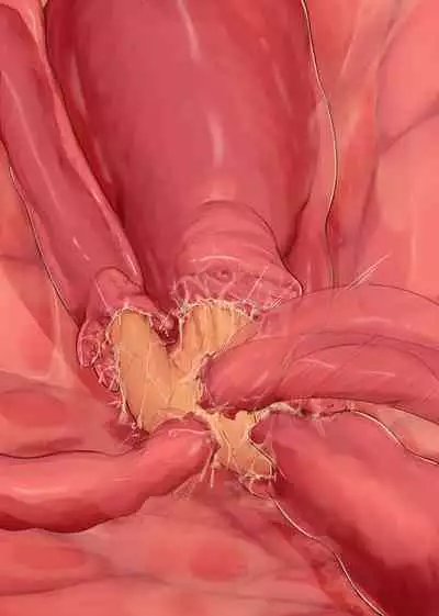 Shokushu Teien | Tentacle Garden