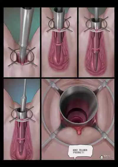 Mad Doc Miss Universe 01-16